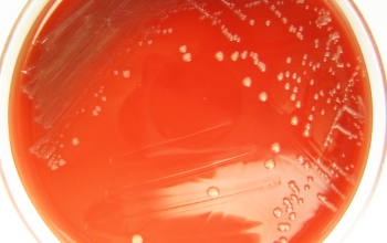 Neisseria elongata Blood Agar 48h culture incubated with CO2