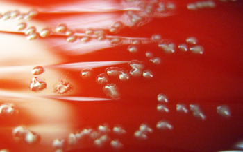 Neisseria elongata Blood Agar 48h culture incubated with CO2