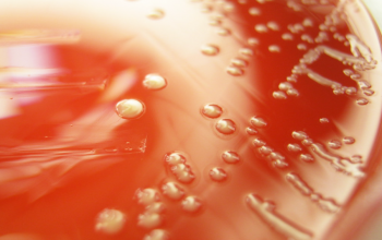 Neisseria elongata Blood Agar 48h culture incubated with CO2