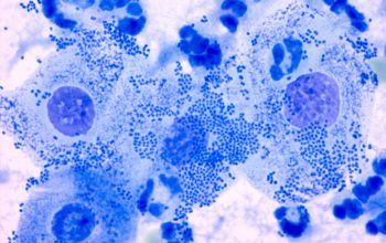 Neisseria gonorrhoeae Methylene blue stain