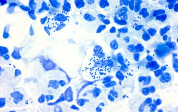Neisseria gonorrhoeae Methylene blue stain