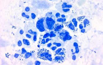 Neisseria gonorrhoeae Methylene blue stain