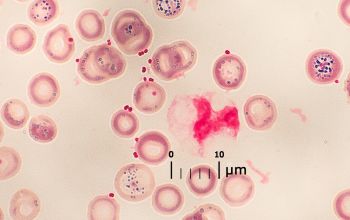 Neisseria meningitidis Gram stain