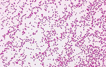 Neisseria sicca Gram stain