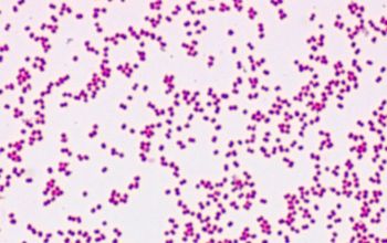 Neisseria sicca Gram stain