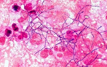 Nocardia astroides Gram stain