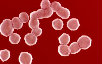 Nocardia astroides  culture incubated with CO2