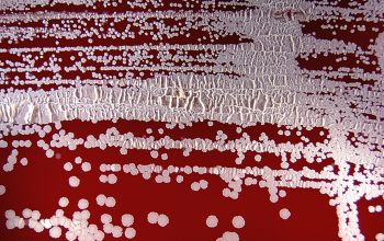 Nocardia astroides Blood Agar 48h culture incubated with CO2