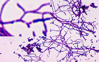 Nocardia astroides Gram stain