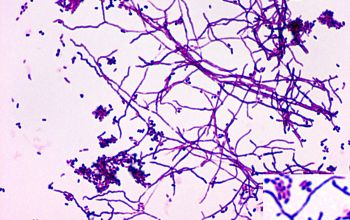 Nocardia astroides Gram stain