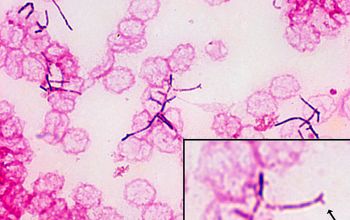 Nocardia farcinica Gram stain