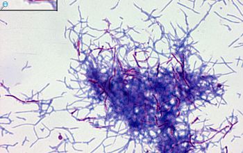 Nocardia astroides 