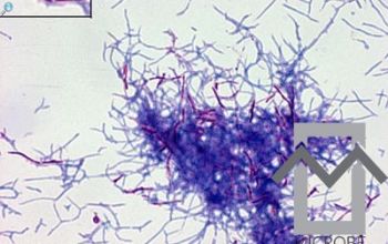 Nocardia farcinica 