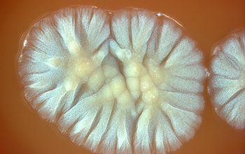 Nocardia brasiliensis  culture incubated with CO2