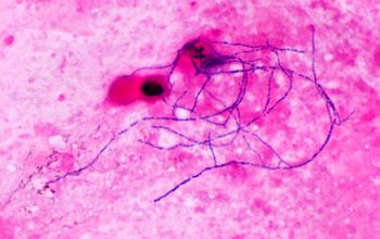 Nocardia brasiliensis Gram stain