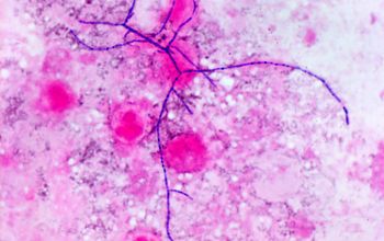 Nocardia brasiliensis Gram stain