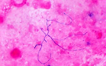 Nocardia brasiliensis Gram stain