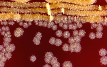 Nocardia farcinica  culture incubated with CO2