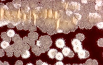 Nocardia farcinica  culture incubated with CO2