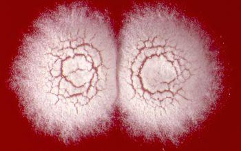 Nocardia nova  culture incubated with CO2