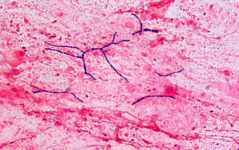 Nocardia nova Gram stain