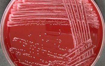 Nocardia paucivorans  culture incubated with CO2