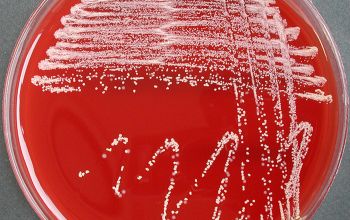 Nocardia paucivorans  culture incubated with CO2