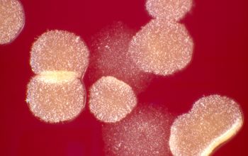 Nocardia paucivorans  culture incubated with CO2