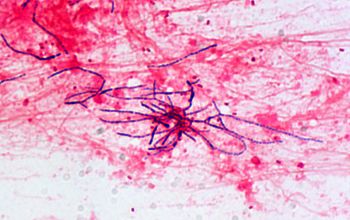 Nocardia paucivorans Gram stain