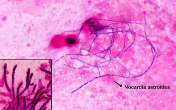Nocardia paucivorans Gram stain