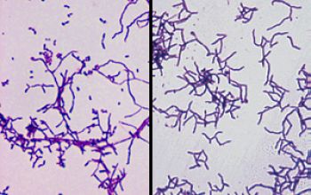 Nocardia astroides 