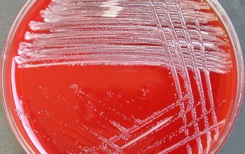 Ochrobactrum anthropi (Brucella anthropi) Blood Agar 24h culture incubated with O2