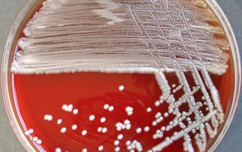 Ochrobactrum anthropi (Brucella anthropi) Blood Agar 48h culture incubated with O2