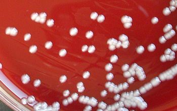 Ochrobactrum anthropi (Brucella anthropi) Blood Agar 48h culture incubated with O2