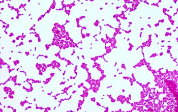 Oligella urethralis Gram stain