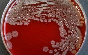 Paenibacillus amylolyticus Blood Agar 48h culture incubated with O2