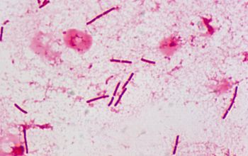 Paenibacillus amylolyticus Gram stain