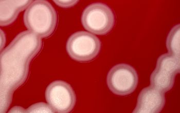 Paenibacillus chibensis Blood Agar 48h culture incubated with O2