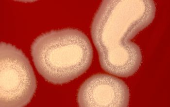 Paenibacillus chibensis  culture incubated with O2
