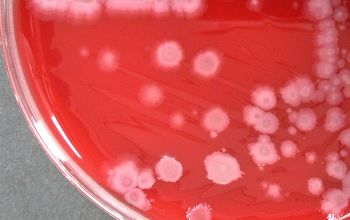 Paenibacillus macerans  culture incubated with CO2