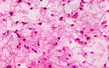 Paenibacillus macerans Wirtz stain