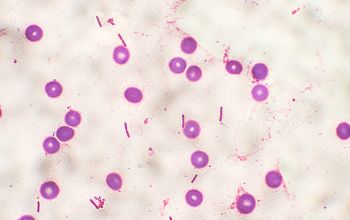 Paenibacillus pabuli Gram stain