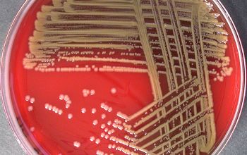 Pantoea agglomerans Blood Agar 24h culture incubated with O2