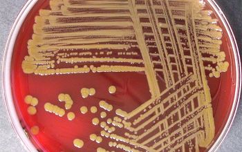 Pantoea agglomerans Blood Agar 48h culture incubated with O2