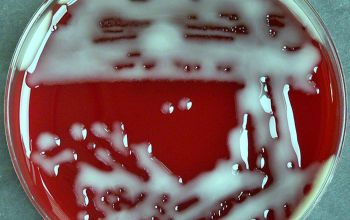 Paracoccus yeei Blood Agar 48h culture incubated with O2