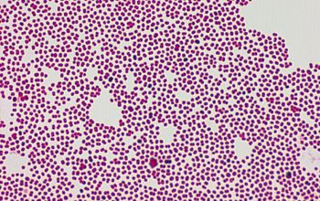 Paracoccus yeei Gram stain