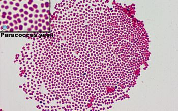 Paracoccus yeei Gram stain