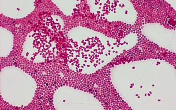 Paracoccus yeei Gram stain