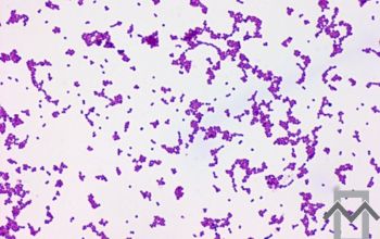 Parvimonas micra Gram stain