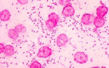 Pasteurella multocida Gram stain